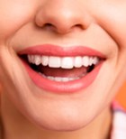 הלבנת שיניים בלייזר - תמונת אווירה